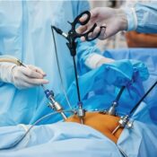 Gen and Laparoscopic