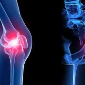 Orthopaedic