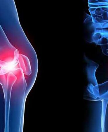 Orthopaedic